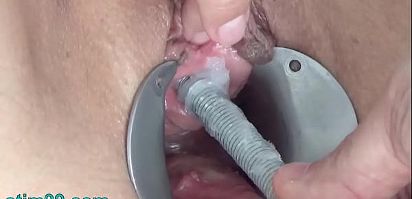  Extreme Peehole Play Fucking with Vibrator and Tortured pisshole with Screw